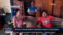 Bocah 9 Tahun di Blora Bobot Tubuhnya Hanya 7,3 Kilogram