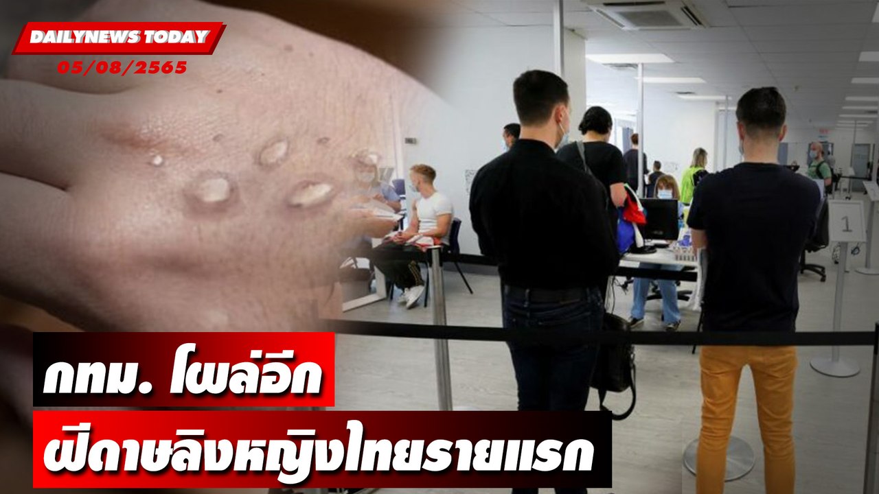 กทม.โผล่อีกฝีดาษลิงหญิงไทยรายแรกเที่ยวแหล่งบันเ...