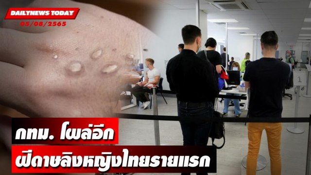 กทม.โผล่อีกฝีดาษลิงหญิงไทยรายแรกเที่ยวแหล่งบันเทิงยอดนิยม | DAILYNEWS TODAY 05/08/65 เดลินิวส์