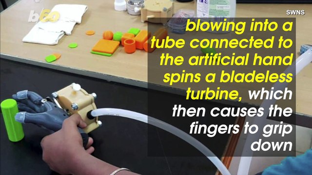 Oxford Engineers Develop Cheap, Lightweight Prosthetic Powered By Breath