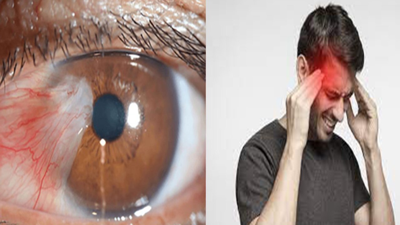 ग्लूकोमा क्या है, Glucoma Symptoms जानना बेहद जरूरी । Boldsky *Health