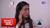 Malalim na acne scars, paano mawawala? | Dapat Alam Mo!