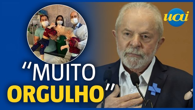 Lula: gêmeos unidos foram separados pelo SUS