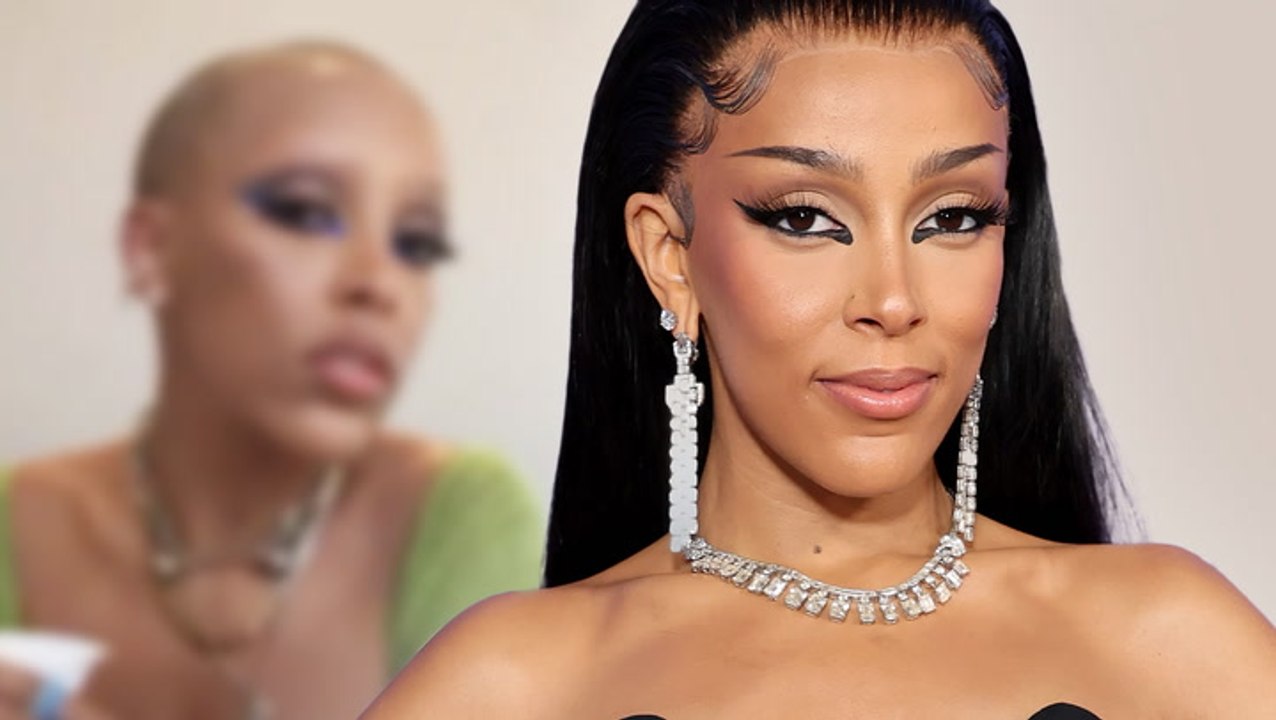 Doja Cat: DARUM rasierte sie sich eine Glatze