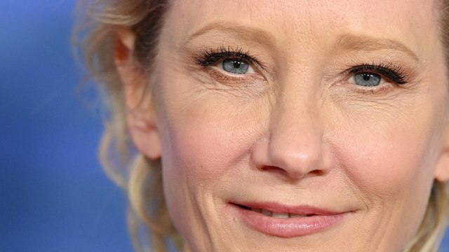VOICI - Anne Heche sévèrement brûlée : l’actrice de Donnie Brasco entre la vie et la mort après un grave accident