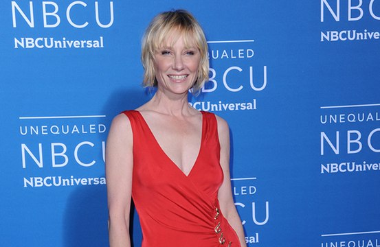 Anne Heche, con graves quemaduras e intubada en un hospital tras un aparatoso accidente automovilístico