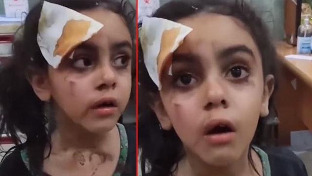 İsrail'in bombalarından yaralı kurtulan küçük kızdan cesur tepki: İsrail devlet bile değil onlar sadece çocuk katili