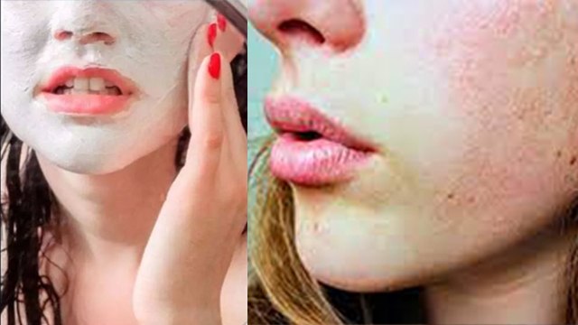 चेहरे पर कच्चा दूध लगाने के नुकसान । Chehre Par Kacha Doodh Lagane Ke Nuksan । Boldsky *Health