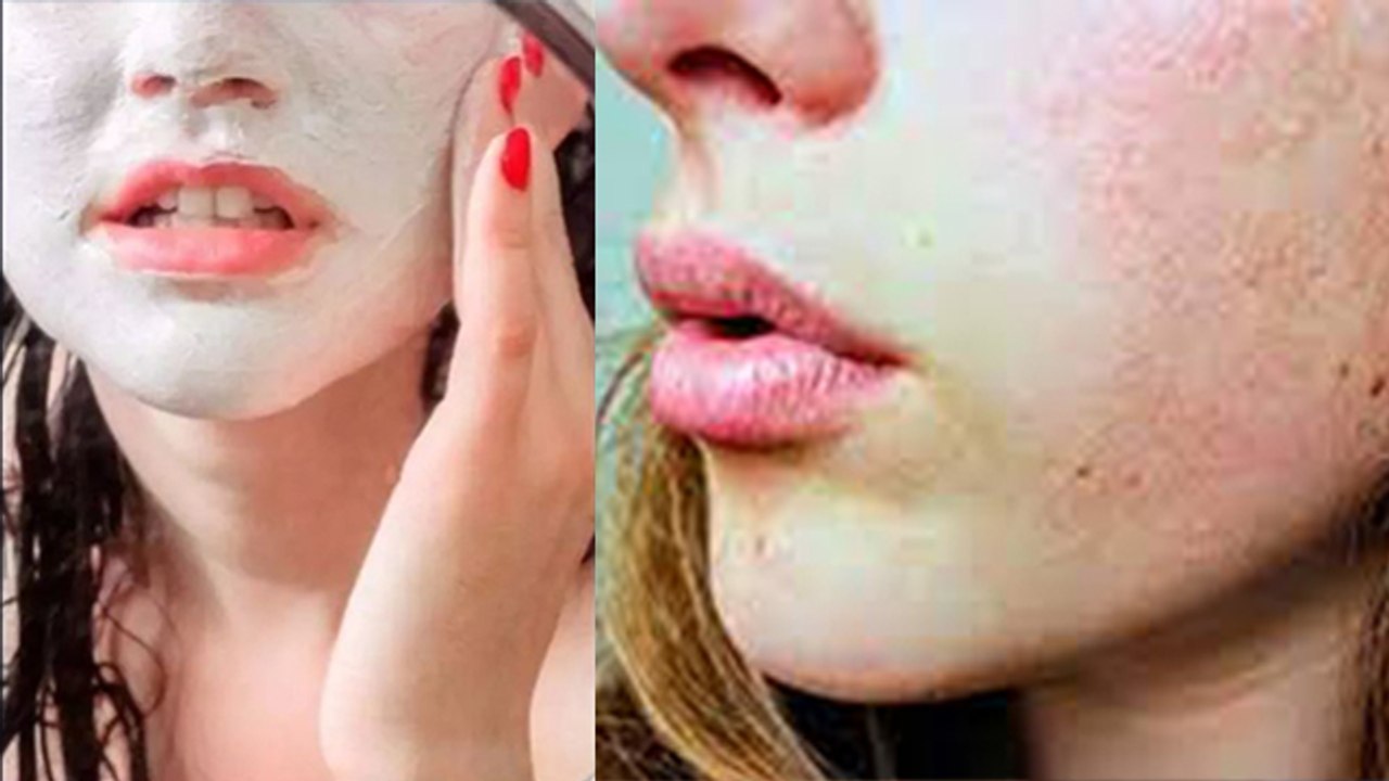 चेहरे पर कच्चा दूध लगाने के नुकसान । Chehre Par Kacha Doodh Lagane Ke Nuksan । Boldsky *Health