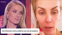 Acidente doméstico de Ana Hickmann vem à tona e artista relata susto: 'Um livramento'