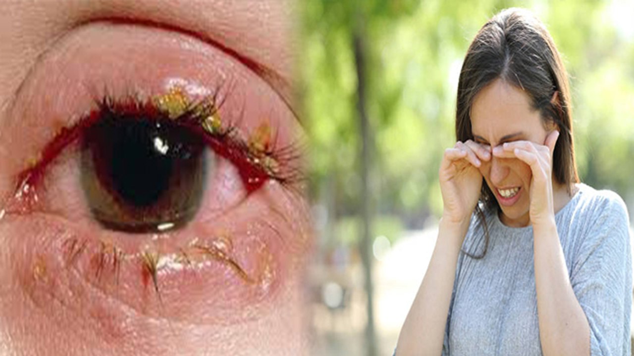 महिलाओं को क्यों होता है Eye Disease Computer V...