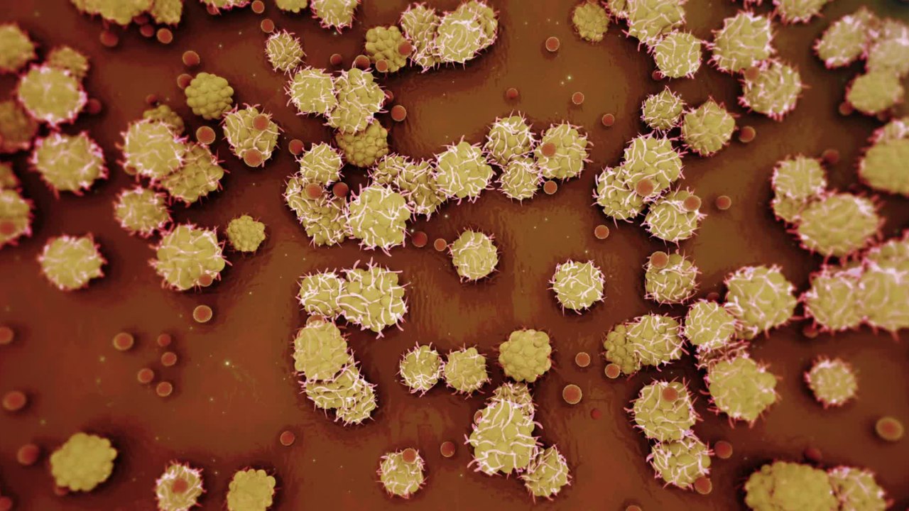 Affenpocken: Erstes Kleinkind infiziert sich in Deutschland mit dem Virus