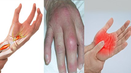 कलाई में दर्द क्यों होता है | Carpal Tunnel Syndrome Reason | Boldsky *Health