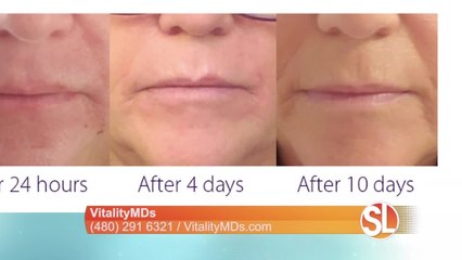 VitalityMDs Aesthetics: Laser treatment to help turn back time