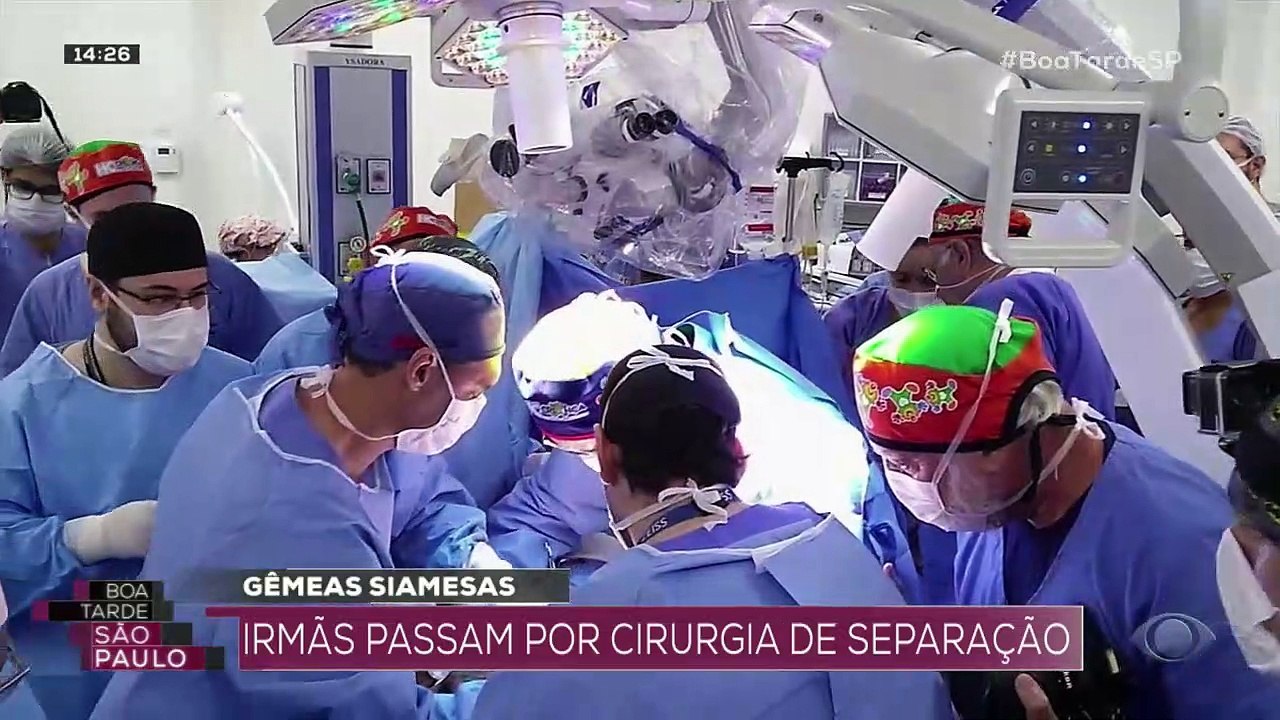 Gêmeas siamesas: irmãs passam por cirurgia de separação