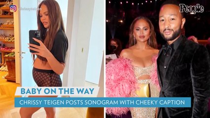 Chrissy Teigen Shares Ultrasound of Baby on the Way — See the Pic!