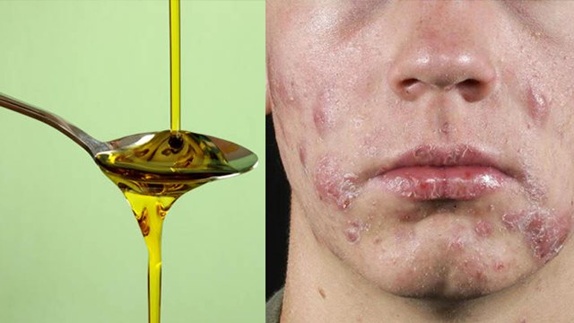 1 चम्मच सरसों का तेल पीने से क्या होता है?। 1 chamach sarso ka tel peene se kya hota hai ।* Health