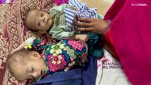 شاهد: بعد عام على حكم طالبان.. الفقر والمرض يتفشيان في أفغانستان