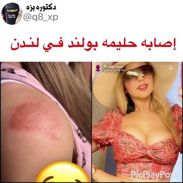 حليمة بولند تتعرض لأزمة صحية كادت تودي بحياتها
