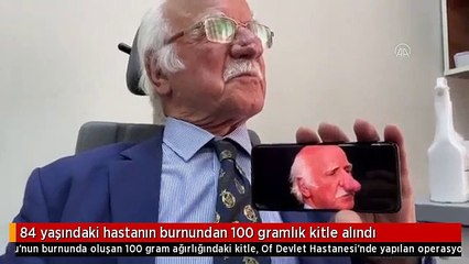 84 yaşındaki hastanın burnundan 100 gramlık kitle alındı