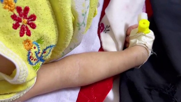 أفغانستان غارقة في الفقر والمرض بعد عام على استحواذ طالبان على الحكم