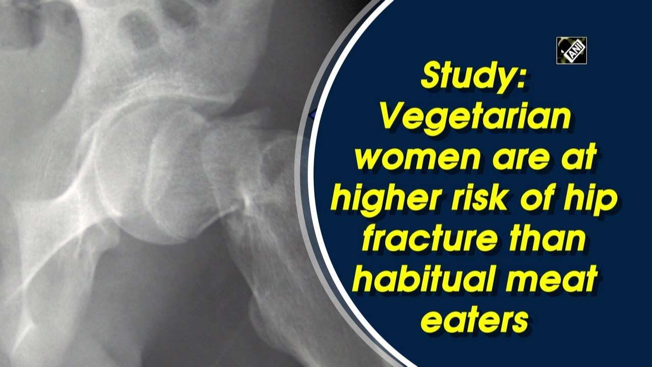 Study: Vegetarian women are at higher risk of hip fracture than habitual meat eaters