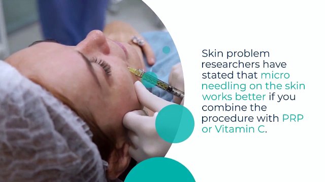 How Effective is Microneedling Aftercare For Acne Scars?