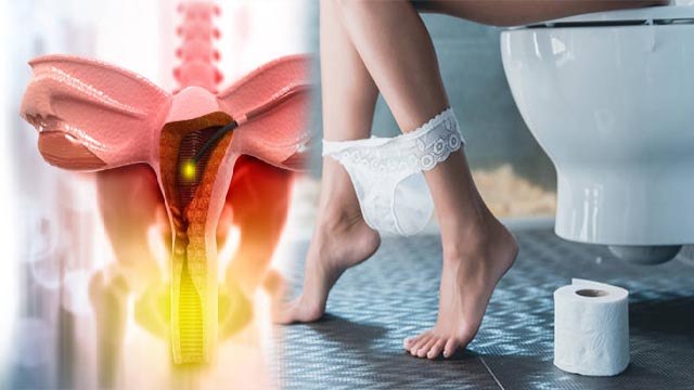 बिना पीरियड ब्लीडिंग होना Dysfunctional Uterine Bleeding Symptoms,तुरंत कराएं जांच | Boldsky *Health