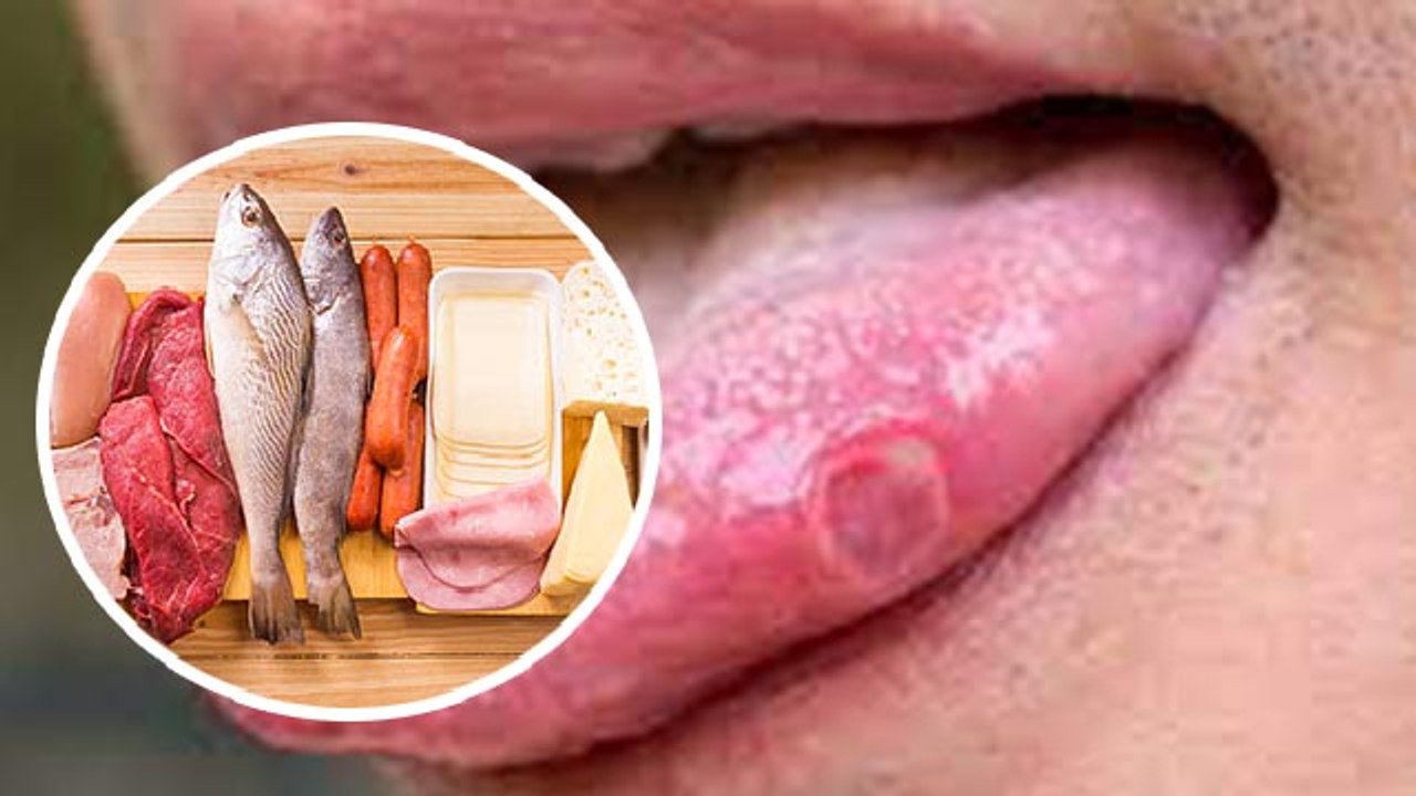 Vitamin B12 Deficiency से क्या होता है। क्या है Vitamin B12 Deficiency Symptoms । Boldsky* Health