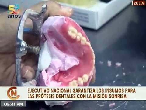 Gobierno Bolivariano garantiza los insumos para las prótesis dentales de la Misión Sonrisa