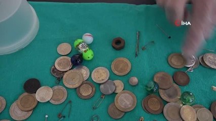 Elazığ haber: Elazığ'da son 1 yılda çocukların midesinden çıkarılanlar görenleri şaşırttı