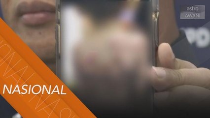 Kanak-kanak 6 tahun didera bapa angkat