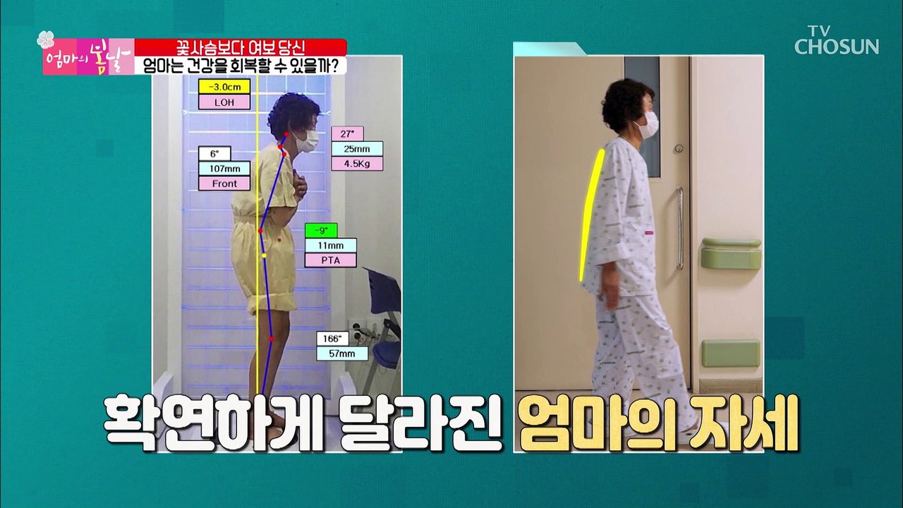엄마의 허리 건강 상태가 수술 후 확연하게 달라진 모습 TV CHOSUN 202208...