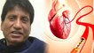 Raju Shrivastav की हुई Angioplasty Kya Hai |  एंजियोप्लास्टी कैसे होती है | Boldsky *Health