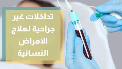 تعرفوا على التداخلات غير الجراحية لعلاج الامراض النسائية