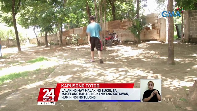 Lalaking may malaking bukol sa maselang bahagi ng kaniyang katawan, humihingi ng tulong.