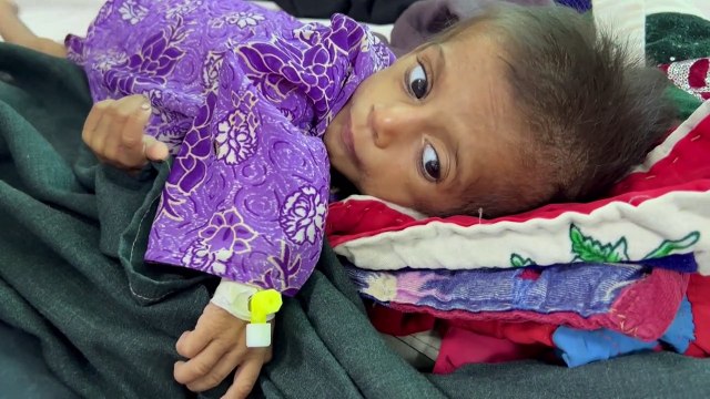 Afganistán se sumerge en la pobreza y la enfermedad tras el regreso de los talibanes