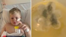 5 yıldır 'astım' teşhisi konulan çocuğun boğazından plastik oyuncak çıktı