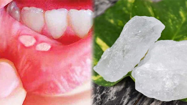 फिटकरी पानी पीने के फायदे | Fitkari Pani Pine Ke Fayde | Boldsky *Health