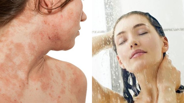 नीम के पानी से नहाने के गंभीर नुकसान । Neem Ke Pani Se Nahane Ke Nuksan । Boldsky *Health