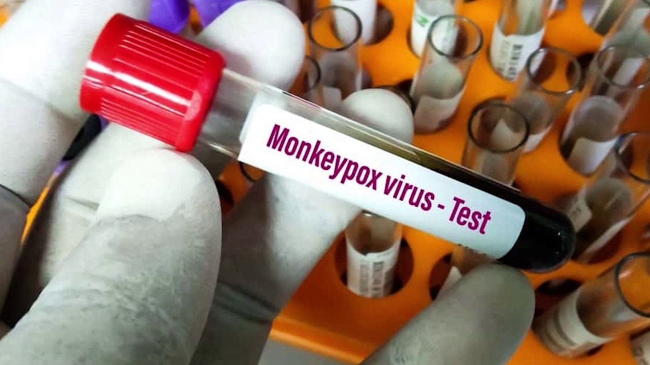 Varíola dos macacos: saiba mais sobre as vacinas e testes para diagnóstico