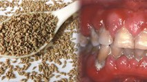 खाना खाने के बाद अजवाइन खाने से क्या होता है।Khana khane ke baad Ajwain khane se kya hota hai*Health