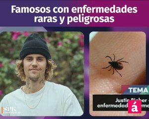 Famosos con enfermedades raras y peligrosas