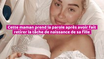 Cette maman prend la parole après avoir fait retiré  la tache de naissance de sa fille