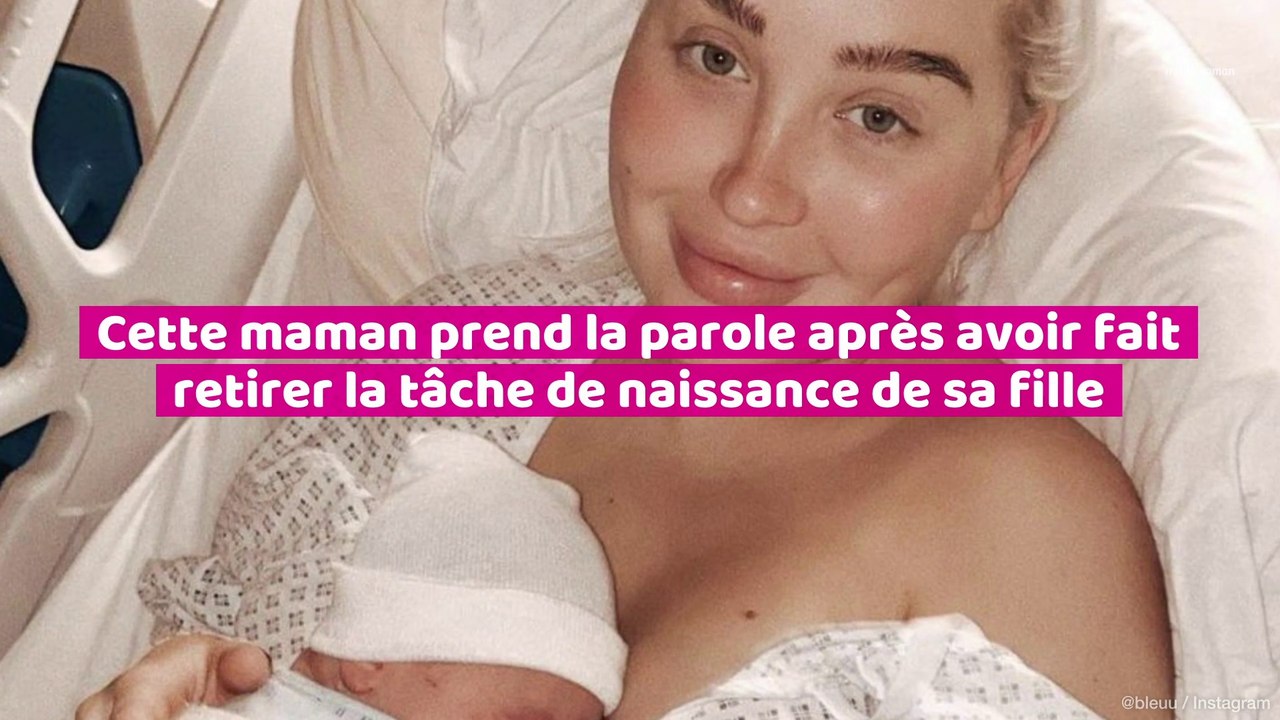 Cette maman prend la parole après avoir fait retiré  la tache de naissance de sa fille