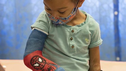 California Hospital Tech Customizes Young Patients’ Casts With Colorful Art
