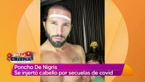 Poncho De Nigris se injerta cabello tras secuelasde covid