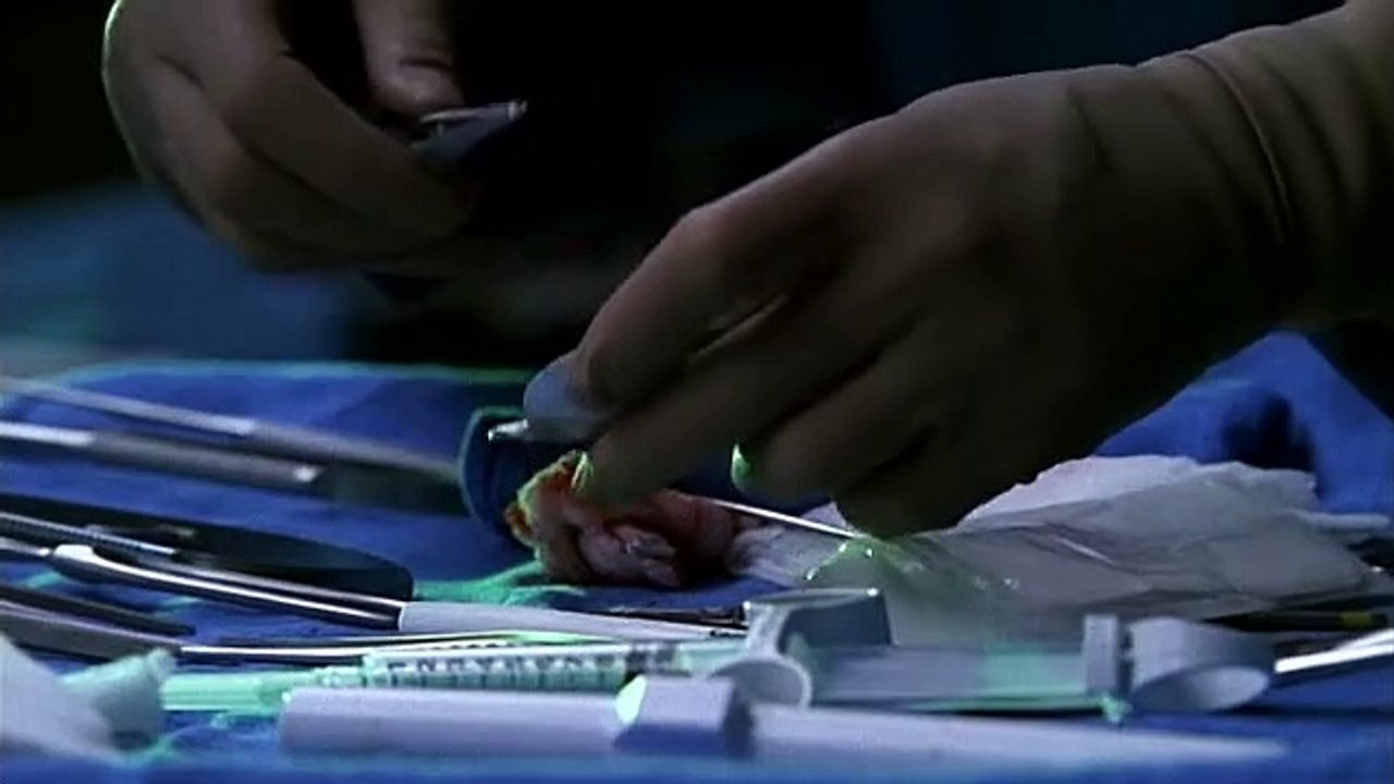Nip-Tuck - Schönheit hat ihren Preis Staffel 1 Folge 5 HD Deutsch