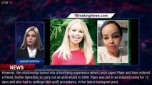 Katie Piper rushed to hospital as effects of horrifying 2008 acid attack continue to manifest - 1bre