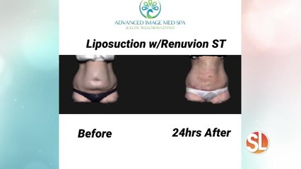 Look younger naturally with Advanced Image Med Spa